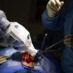 The Rise of Robotic Surgery in India: A Revolutionary Approach or Just Hype?