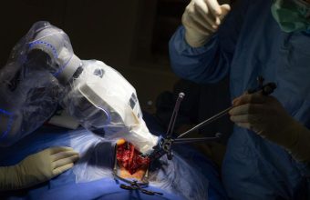 The Rise of Robotic Surgery in India: A Revolutionary Approach or Just Hype?