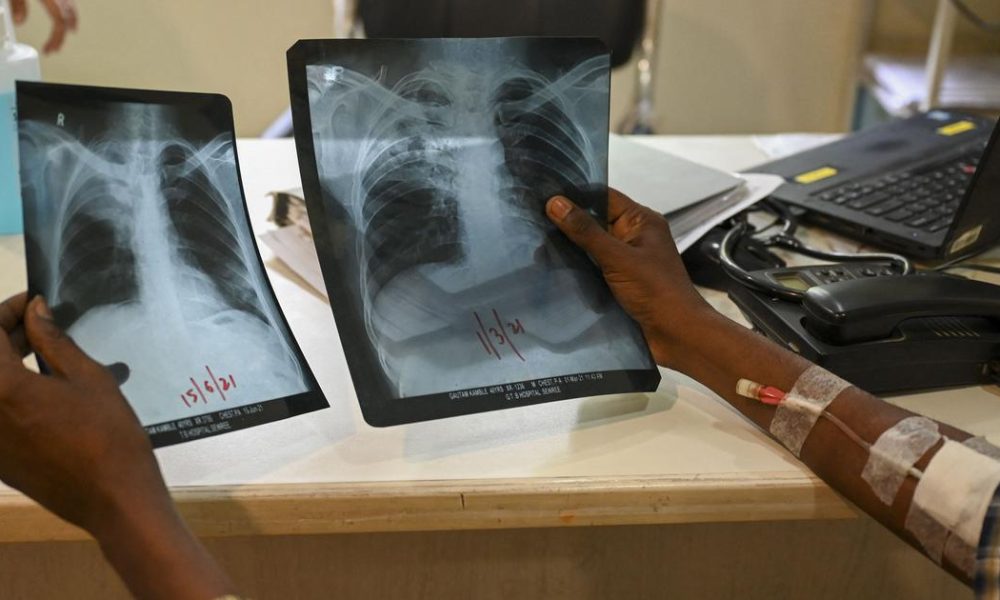 Lessons from Lakshadweep: A Model for TB Elimination in India