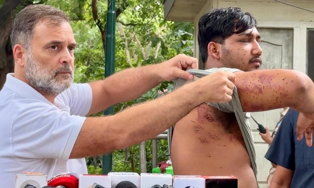 Rahul Gandhi Challenges Government Over Pellet Gun Allegations Amid Ongoing Protests