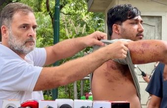 Rahul Gandhi Challenges Government Over Pellet Gun Allegations Amid Ongoing Protests