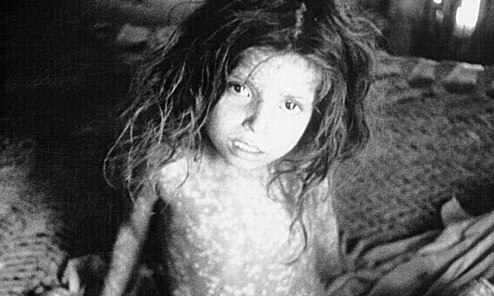Colonial India and Smallpox: A Challenge to Britain’s Perceived Superiority