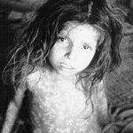 Colonial India and Smallpox: A Challenge to Britain’s Perceived Superiority