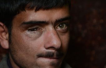 Kashmir Pellet Gun Victims Await Justice and Compensation Even After a Decade