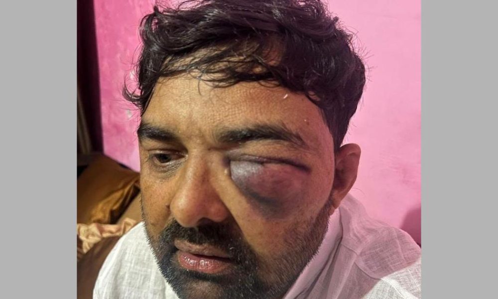 Samajwadi Party Workers Accuse Meerut Police Chief of Brutal Assault