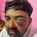 Samajwadi Party Workers Accuse Meerut Police Chief of Brutal Assault