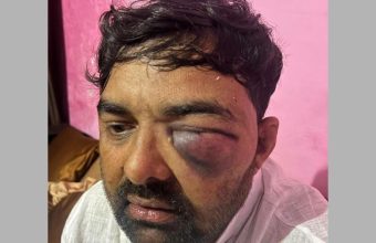 Samajwadi Party Workers Accuse Meerut Police Chief of Brutal Assault