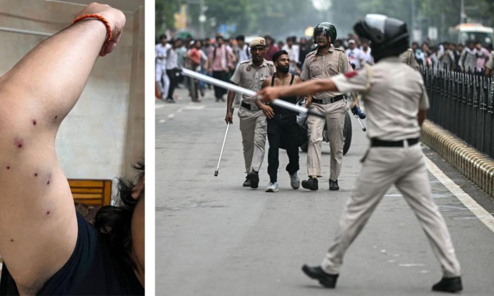 Youth Protest in Delhi Results in Pellet Injuries, RTI Reveals Disturbing Details