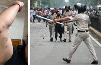 Youth Protest in Delhi Results in Pellet Injuries, RTI Reveals Disturbing Details