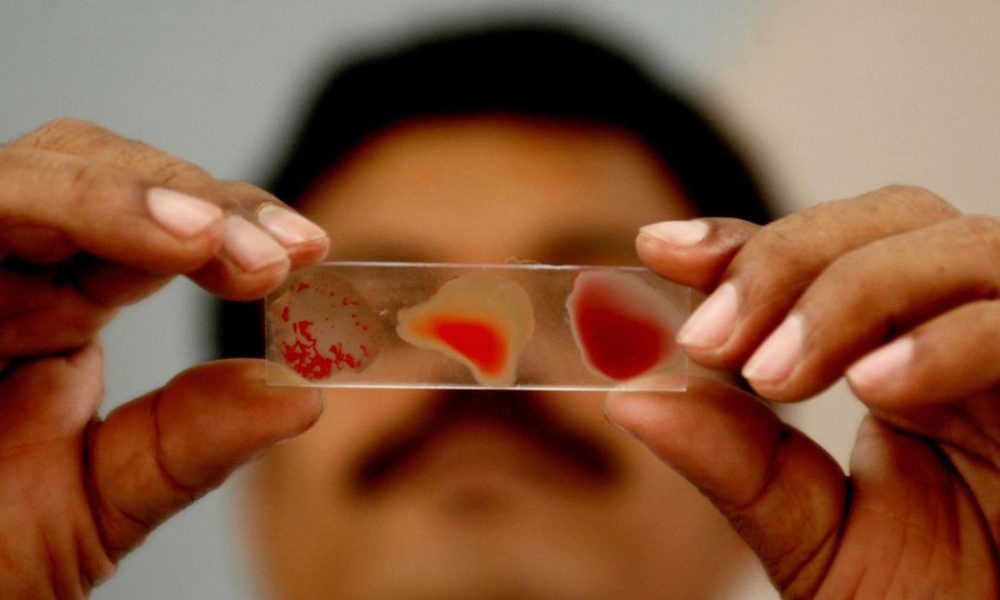 India Lacks Data on Anemia Among Women and Children for the First Time in 30 Years
