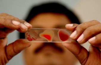 India Lacks Data on Anemia Among Women and Children for the First Time in 30 Years