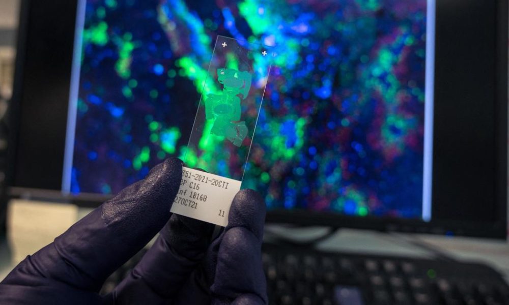 New WHO Study Reveals Infection-Linked Cancer Cases Could Reach 12% Globally in 2024