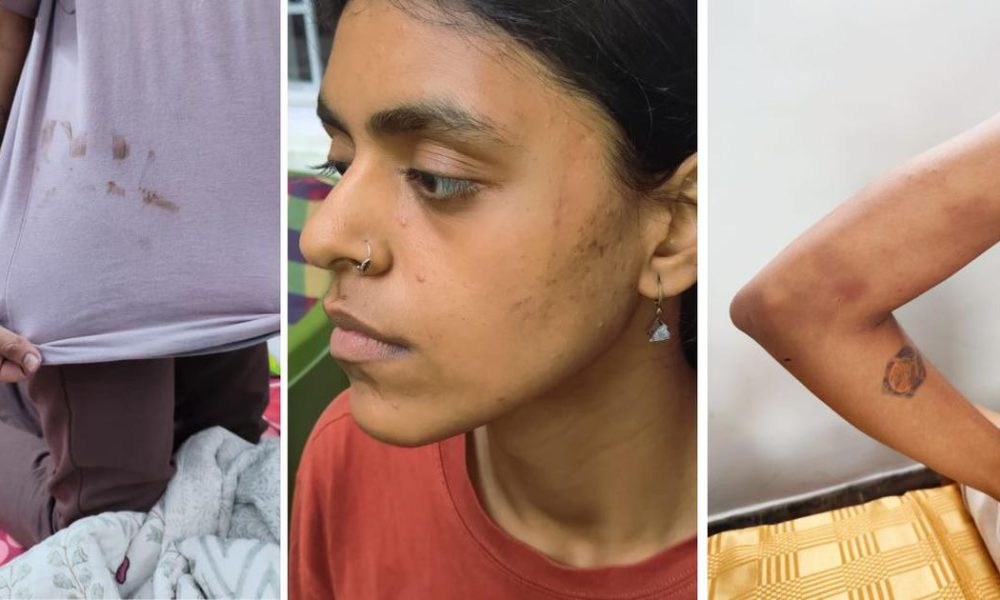 Protesters Allege Brutality and Misconduct by Delhi Police During Arrests