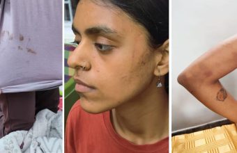 Protesters Allege Brutality and Misconduct by Delhi Police During Arrests